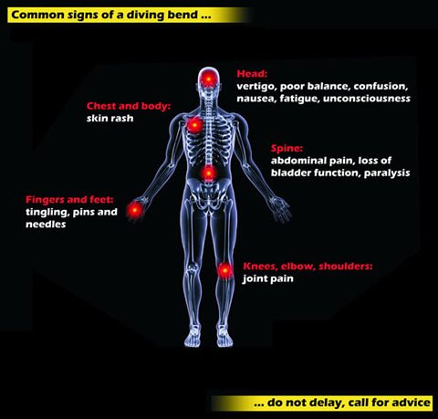 infographic showing physical signs of decompression sickness